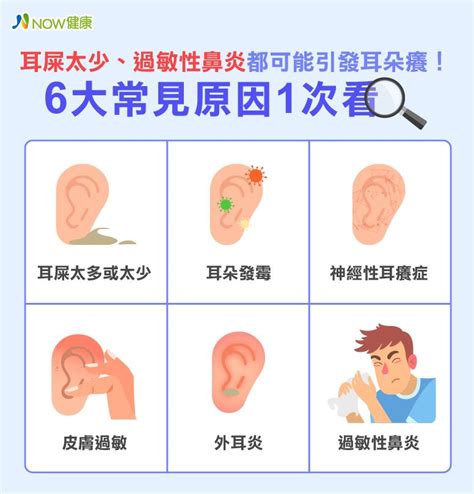 耳朵癢 時間|耳朵癢是耳屎太多？6大原因、4招緩解 專家1次告訴。